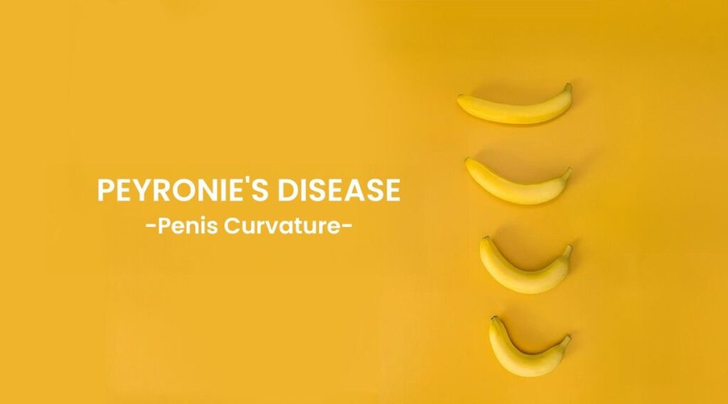 mahi_andrology-Peyronie’s Disease
